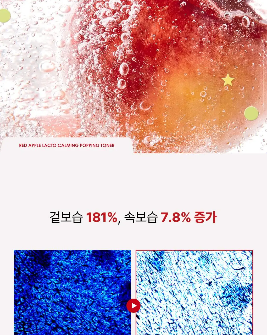 [NEW/단독기획] rdrd 레드 애플 락토 진정 팝핑 토너 95g 응급진정 KIT 기획 상세페이지 11